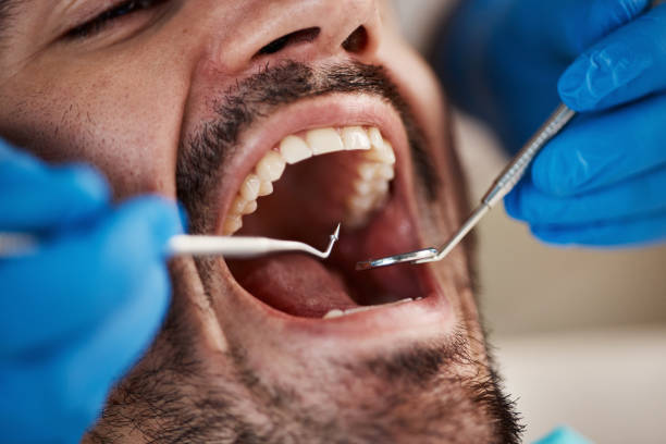 Best Urgent Care for Lost Fillings or Crowns in Trenton, NJ