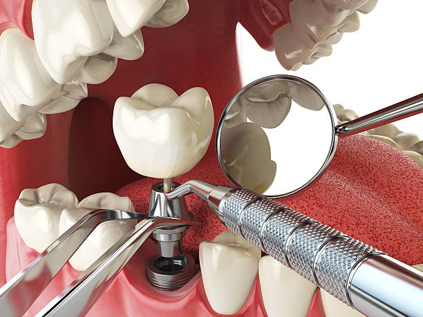 Best Emergency Denture Repair in Trenton, NJ